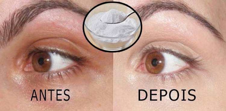 Acabe com as olheiras com este unico ingrediente Acabe com as olheiras com este único ingrediente