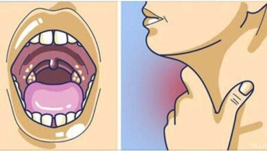 Antibiótico natural para tratar todo tipo de infecção na garganta