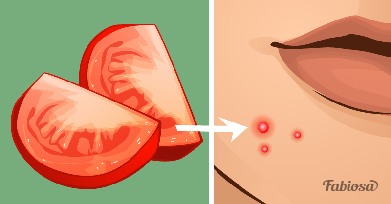 Aplique tomates no seu rosto e veja a magica acontecer.pn 2-apply_tomatoes_to_your_fa