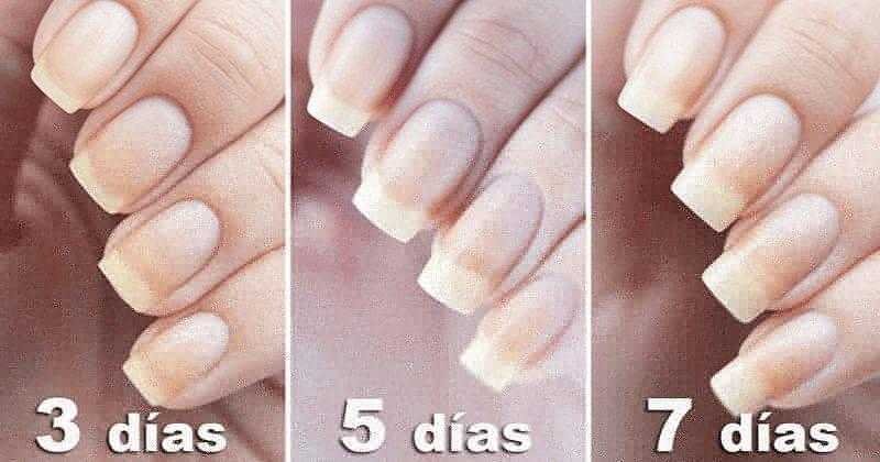 Aprenda a usar bicarbonato para ter unhas mais longas e Aprenda a usar bicarbonato para ter unhas mais longas e fortes