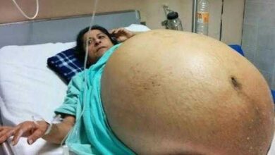 Barriga de mulher começa a crescer misteriosamente e você ficará CHOCADO com o que havia dentro