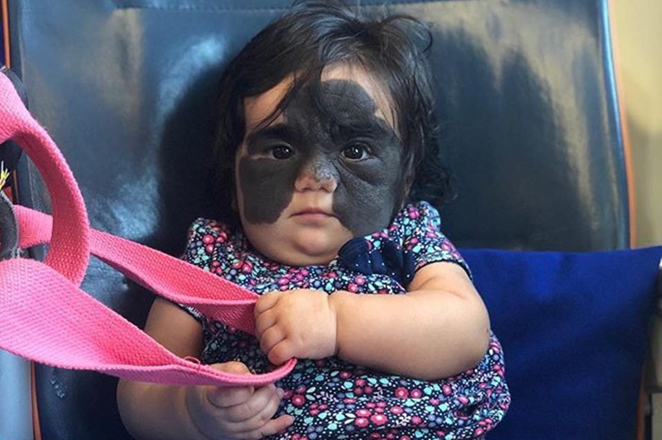 bebê é chamada de monstro por causa de sua aparência e mãe desabafa