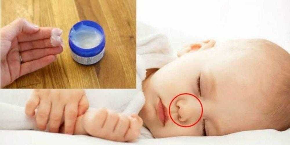 Bebê morre após mãe aplicar Vick Vaporub em seu nariz