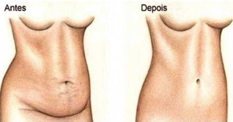 Bebida caseira pode levar a perder 3 kg Bebida caseira, pode levar a perder 3 kg