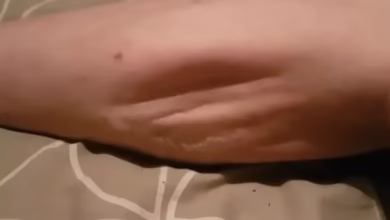 Câimbras noturnas: o que fazer para aliviar as dores?