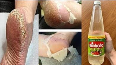 Como afinar os pés e acabar com rachaduras