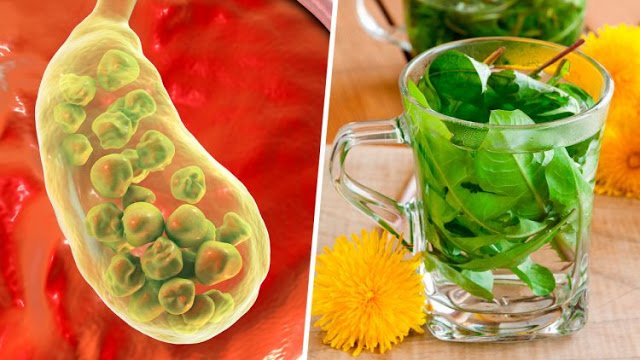 Como eliminar pedras da vesicula naturalmente