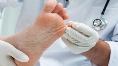 Como evitar frieiras nos pés e nas mãos