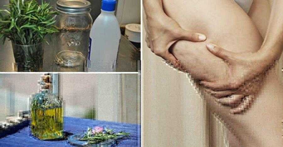 Como fazer álcool de Alecrim e elimine a gota, varizes, dor muscular e celulite d