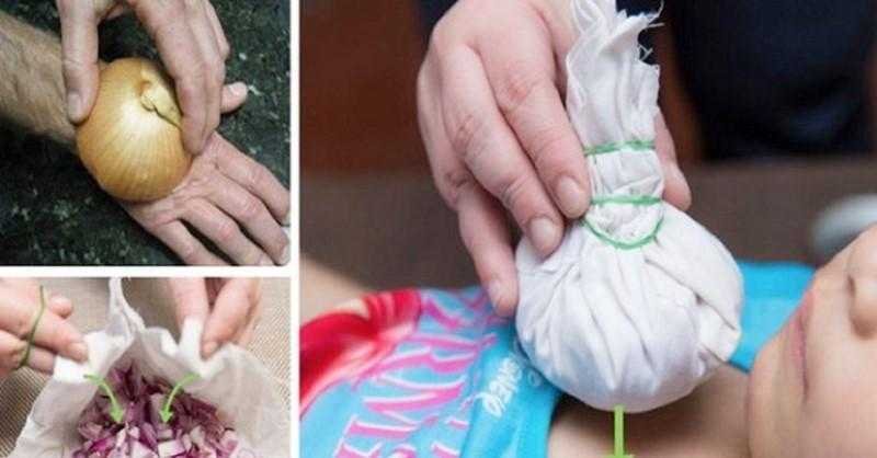 Como usar a cebola para tratar 9 doencas comuns no Como usar a cebola para tratar 9 doenças comuns no dia-a-dia