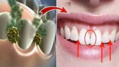 Destrua o mau hálito utilizando este remédio natural