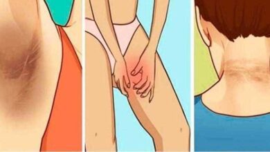Dicas para remover manchas escura do pescoço e axilas