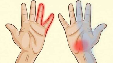 Dormência nas Mão, uma doença pode está acontecendo com você