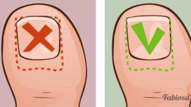 Ela sofria com unhas encravadas por varios anos ate que Ela sofria com unhas encravadas por vários anos até que aprendeu essas dicas simples