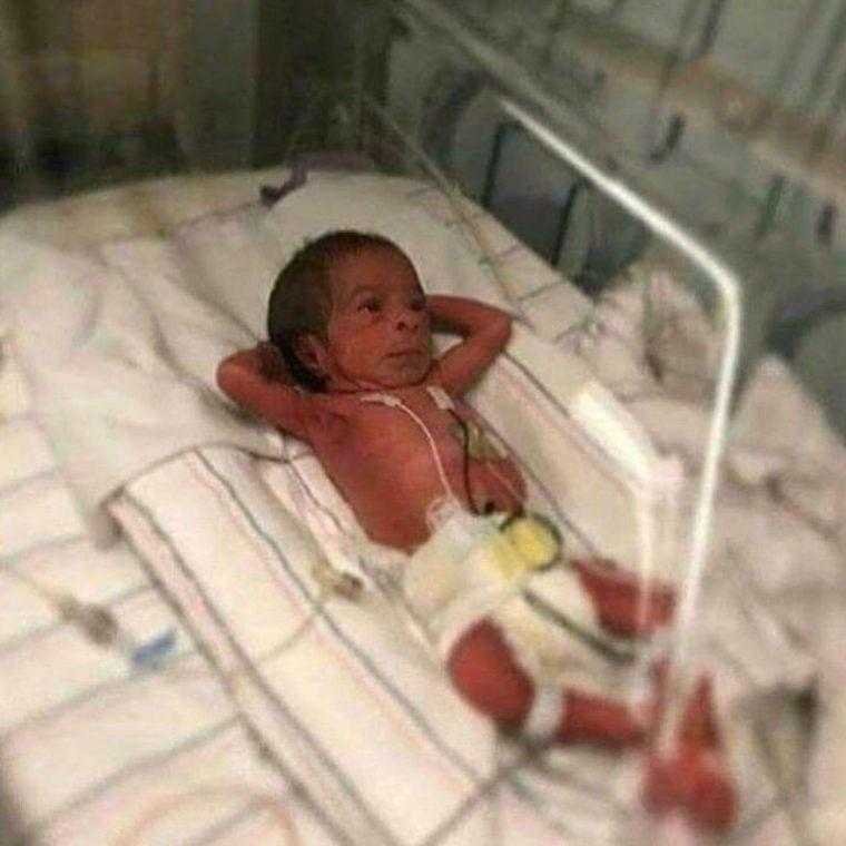 Ele nasceu ha poucas horas mas a foto ja deu Ele nasceu há poucas horas, mas a foto já deu a volta ao mundo d