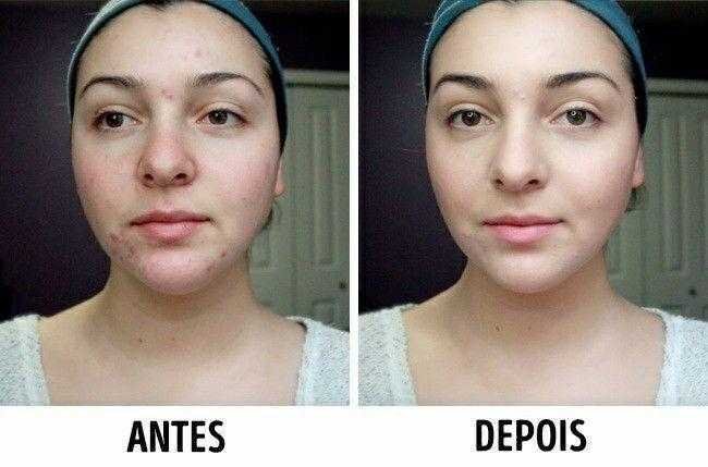 Este soro vitaminado vai nutrir sua pele e fara voce Este soro vitaminado vai nutrir sua pele e fará você ficar alguns anos mais jovem