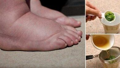 Excelente remédio caseiro para pernas e pés inchados