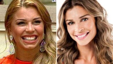 Fotos que mostram o antes e depois do sorriso dos famosos deixarão todos perplexos