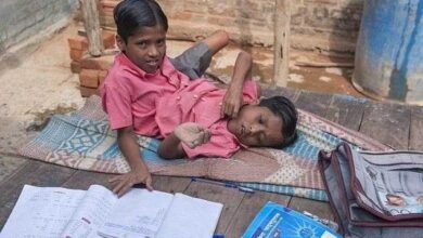 Gemeos siameses de 12 anos sao adorados como encarnacoes divinas Gêmeos siameses de 12 anos, são adorados como encarnações divinas