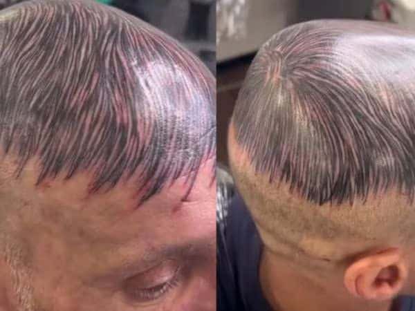 Homem desesperado por sua calvície tatua a cabeça
