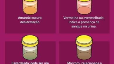 Isto é o que a cor da urina indica sobre sua saúde – Saiba o que pode estar prejudicando sua saúde!