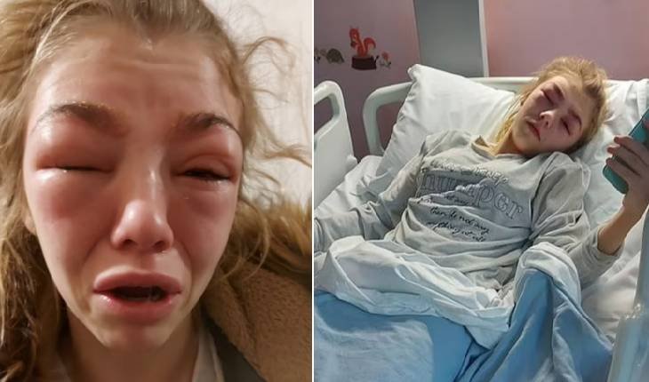 Jovem quase perde a vida ao realizar procedimento que muitas