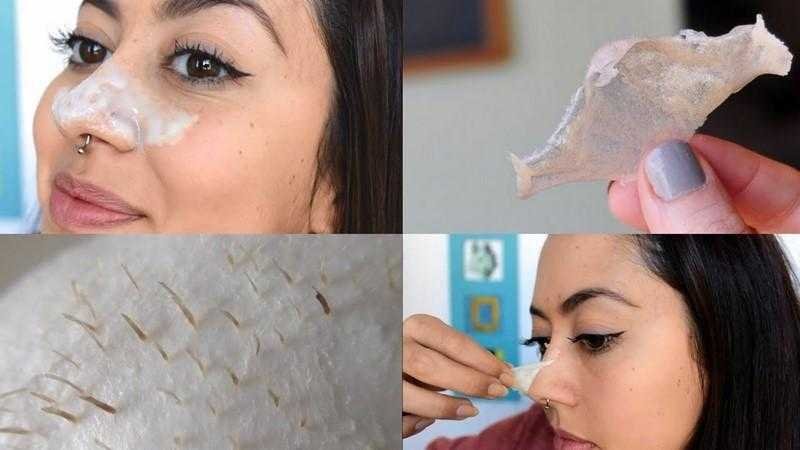 Mascara Caseira que Remove os Cravos em 10 minutos Máscara Caseira que Remove os Cravos em 10 minutos