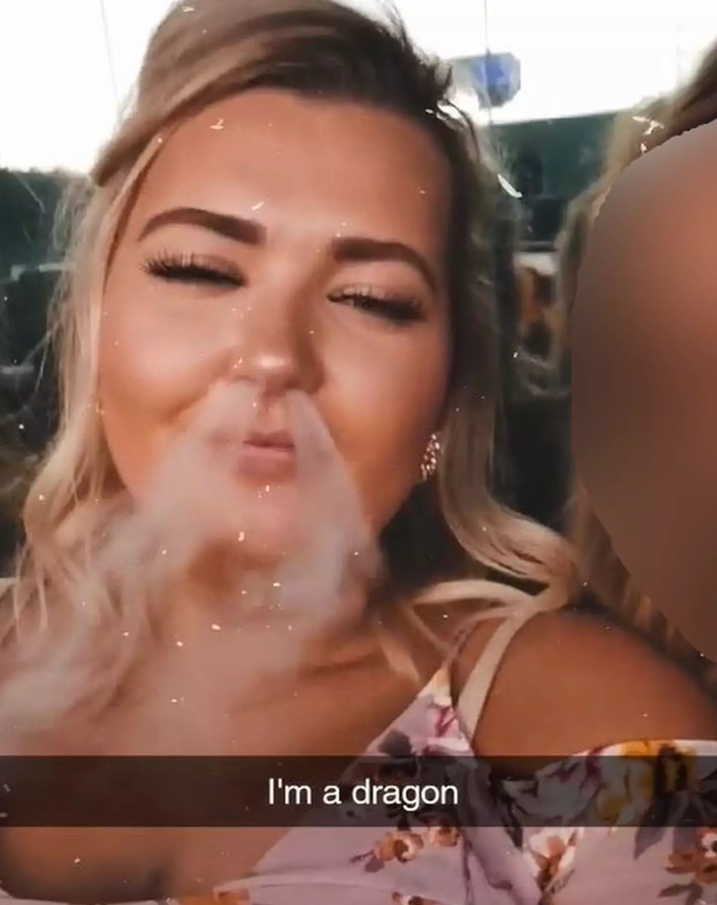 Mulher ficou com pulmões de uma pessoa de 80 anos após vape 