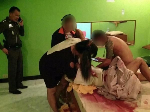 Noite de amor termina em hospital apos tentativa de posicao