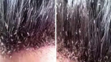 Passageiros se chocam ao ver o que tinha no cabelo da mulher e o vídeo viraliza