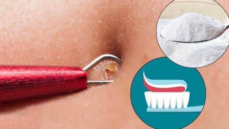 Receita caseira para tirar cravos e espinhas em 2 minutos Receita caseira para tirar cravos e espinhas em 2 minutos d