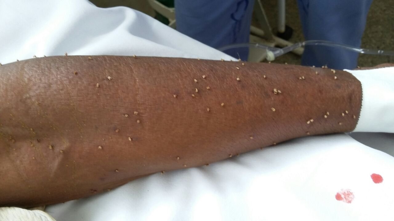 Senhora morre apos ser picada por cerca de 500 abelhas