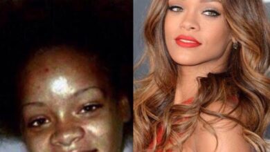 Veja como eram essas celebridades antes da fama