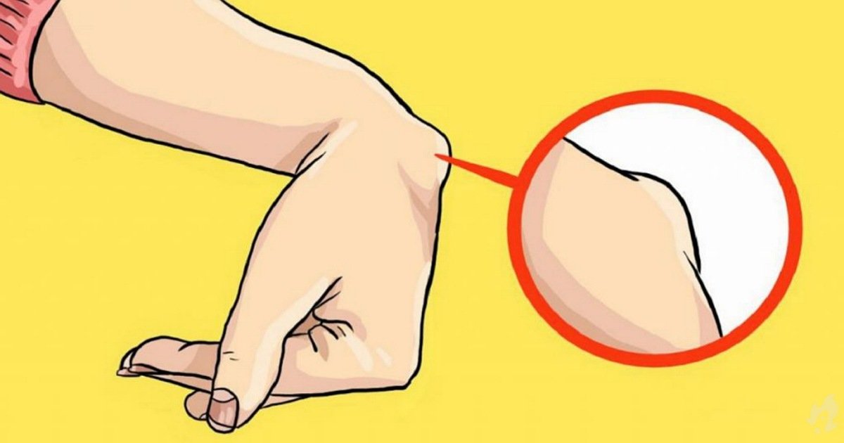 Você tem esse caroço no pulso