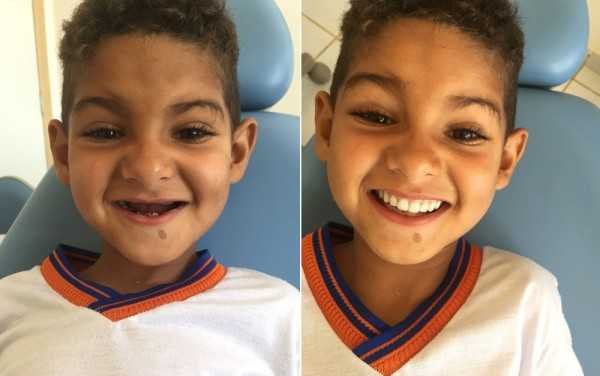 agora posso rir porque tenho meus dentes afirma garoto que