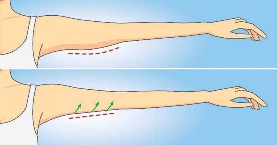 aprenda maneiras simples de reduzir a gordura do braco Aprenda maneiras simples de reduzir a gordura do braço 1