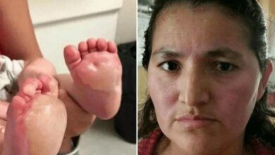 Bebê fica com bolhas enormes em seus pés. Mas depois, sua mãe descobre o que a babá horrível fez!