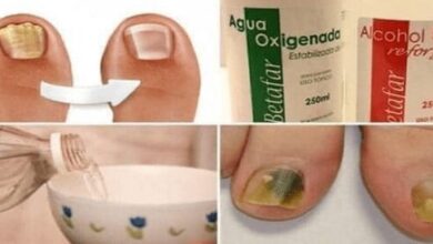 Bomba exterminadora de fungos | Bau das DICAS