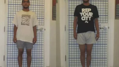 sam passou por uma cirurgia que o ajudou a ganhar alguns centimetros