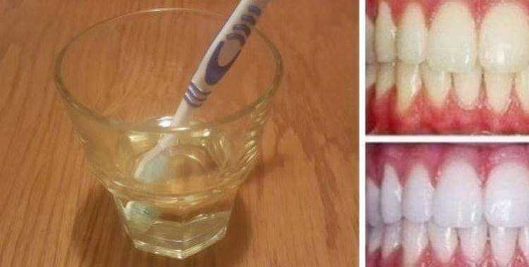 Clareamento dental caseiro de vinagre de maçã