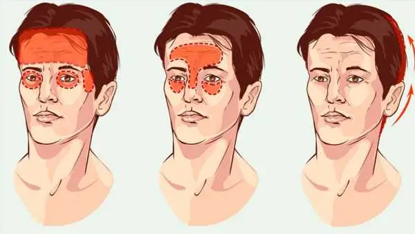 Como diferenciar uma enxaqueca de uma dor de cabeça emocional