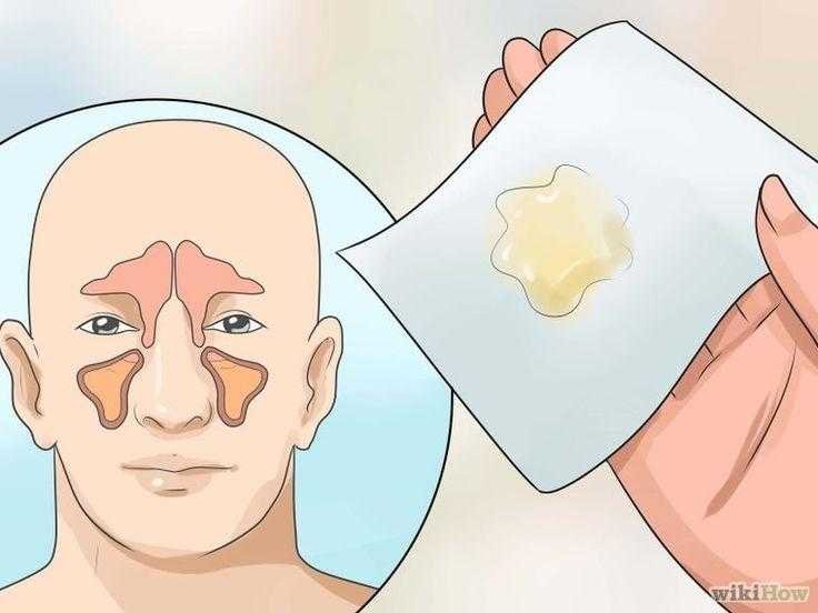 como eliminar a congestao nasal em poucos minutos Como eliminar a congestão nasal em poucos minutos