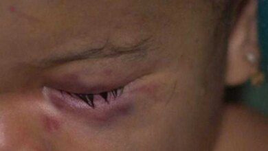 Criança desmaia em escola: “Chorei ao notar que era fome”, diz professora.