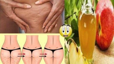 Descubra como usar o vinagre de maçã para tratar celulite