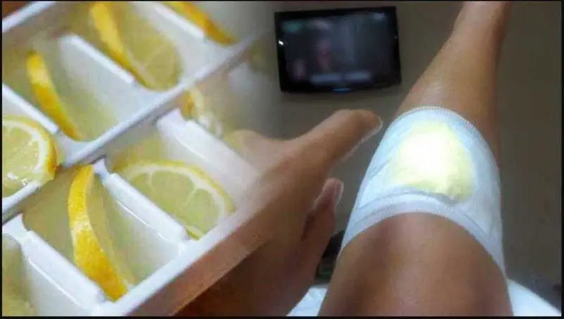 Elimine as suas dores nos joelhos com uma simples receita caseira