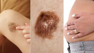 Estes são os 20 sinais de câncer que quase todas as mulheres ignoram!