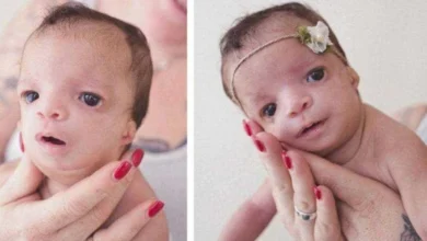 Família adotiva foge do hospital ao ver a cara da bebê