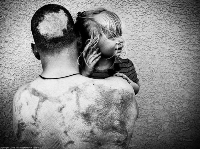 fotos chocantes mostra como vivem os veteranos depois das guerras
