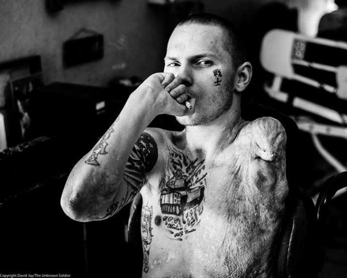fotos chocantes mostra como vivem os veteranos depois das guerras