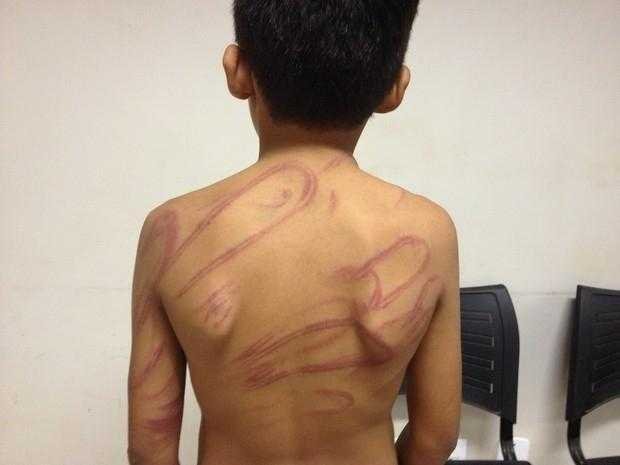 Mãe é presa após surra filho de 7 anos com chibatadas de cipó